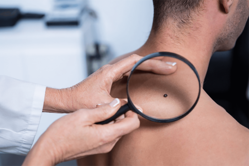 dermatologia-oncologica-800×450